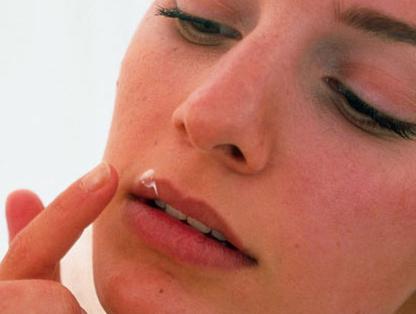 hvordan man kan slippe af med forkølelse på læberne